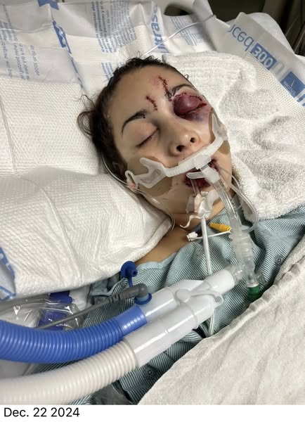 Justice Denied: Survivor Shocked as Perpetrator Receives Plea Deal in Brutal Assault Case